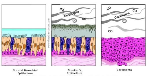 Dangerous Effects of Smoking